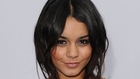 How Vanessa Hudgens Popped Blood Vessels In Her Face